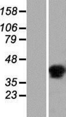 Western Blot C6orf58 Overexpression Lysate