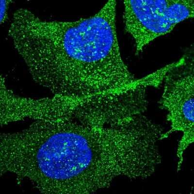 Immunocytochemistry/Immunofluorescence: C6orf72 Antibody [NBP2-38489] - Staining of human cell line U-2 OS shows localization to nucleoli fibrillar center & plasma membrane.