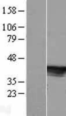 Western Blot: C6orf81 Overexpression Lysate (Adult Normal) [NBL1-08539] Left-Empty vector transfected control cell lysate (HEK293 cell lysate); Right -Over-expression Lysate for C6orf81.