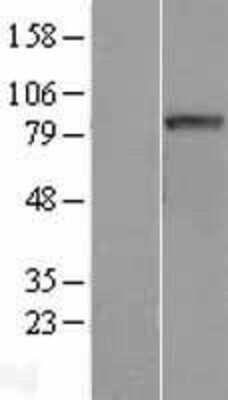 Western Blot CCDC170 Overexpression Lysate