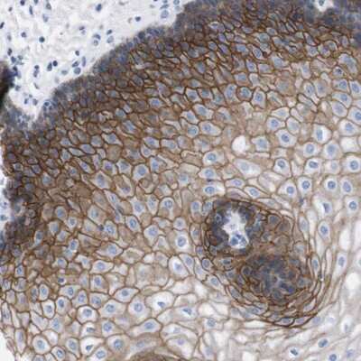 Immunohistochemistry-Paraffin: C7orf23 Antibody [NBP1-81080] - Staining of human esophagus shows strong membranous and cytoplasmic positivity in squamous epithelial cells.