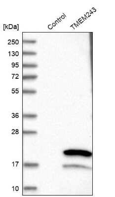 Western Blot: C7orf23 Antibody [NBP1-81080] - Analysis in control (vector only transfected HEK293T lysate) and TMEM243 over-expression lysate (Co-expressed with a C-terminal myc-DDK tag (3.1 kDa) in mammalian HEK293T cells).
