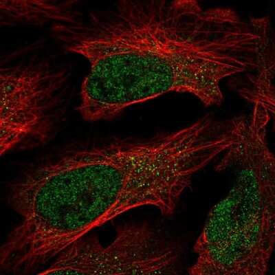 Immunocytochemistry/Immunofluorescence: C7orf25 Antibody [NBP2-56786] - Staining of human cell line U-2 OS shows localization to nucleoplasm.