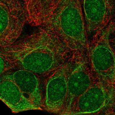 Immunocytochemistry/Immunofluorescence: C7orf26 Antibody [NBP2-55233] - Staining of human cell line MCF7 shows localization to nucleus, nucleoli, cytosol & intermediate filaments.