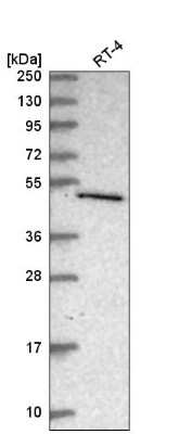 Western Blot: C7orf26 Antibody [NBP2-55233] - Analysis in human cell line RT-4.