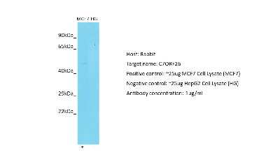Western Blot: C7orf26 Antibody [NBP2-84567] - Host: Rabbit. Target: C7ORF26. Positive control (+): MCF7 Cell Lysate (N10). Negative control (-): HepG2 Cell Lysate (HG). Antibody concentration: 1ug/ml