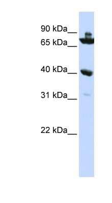 Western Blot: C7orf31 Antibody [NBP1-56351] - HepG2 cell lysate, concentration 0.2-1 ug/ml.