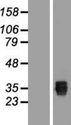 Western Blot: C7orf45 Overexpression Lysate (Adult Normal) [NBL1-08557] Left-Empty vector transfected control cell lysate (HEK293 cell lysate); Right -Over-expression Lysate for C7orf45.