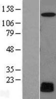 Western Blot: C7orf49 Overexpression Lysate (Adult Normal) [NBL1-08558] Left-Empty vector transfected control cell lysate (HEK293 cell lysate); Right -Over-expression Lysate for C7orf49.