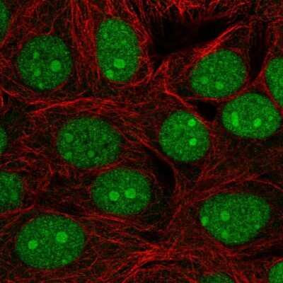 Immunocytochemistry/Immunofluorescence: C7orf50 Antibody [NBP2-30873] - Staining of human cell line MCF7 shows localization to nucleus & nucleoli. Antibody staining is shown in green.