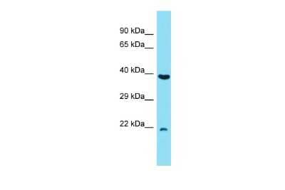 Western Blot: C7orf50 Antibody [NBP2-84568] - Host: Rabbit. Target Name: C7orf50. Sample Type: RPMI-8226 Whole Cell lysates. Antibody Dilution: 1.0ug/ml