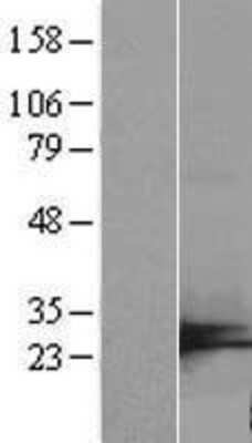 Western Blot: C7orf50 Overexpression Lysate (Adult Normal) [NBP2-09541] Left-Empty vector transfected control cell lysate (HEK293 cell lysate); Right -Over-expression Lysate for C7orf50.