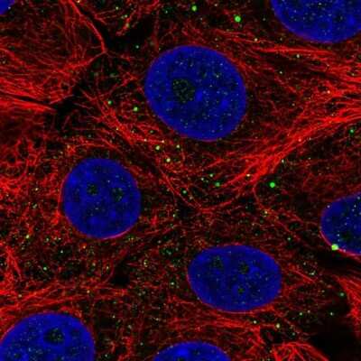Immunocytochemistry/Immunofluorescence: C7orf61 Antibody [NBP2-32540] - Staining of human cell line MCF7 shows localization to vesicles.