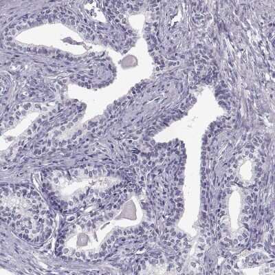 Immunohistochemistry-Paraffin: C7orf61 Antibody [NBP2-32540] - Staining of human prostate shows low expression as expected.