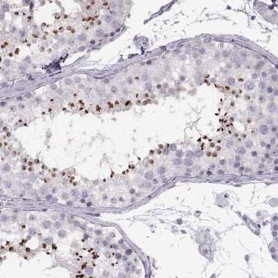 Immunohistochemistry-Paraffin: C7orf61 Antibody [NBP2-32540] - Staining of human testis shows high expression.