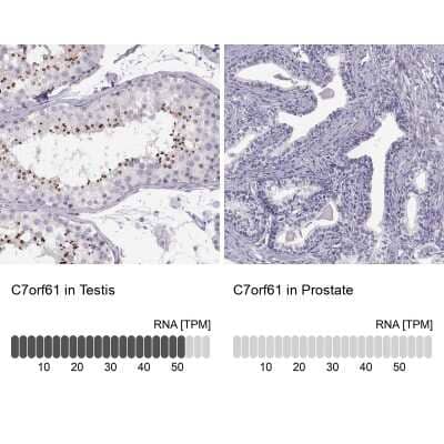 <b>Orthogonal Strategies Validation. </b>Immunohistochemistry-Paraffin: C7orf61 Antibody [NBP2-32540] - Staining in human testis and prostate tissues using anti-C7orf61 antibody. Corresponding C7orf61 RNA-seq data are presented for the same tissues.