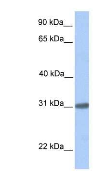 Western Blot: C7orf61 Antibody [NBP1-56948] - Human Brain lysate, concentration 0.2-1 ug/ml.