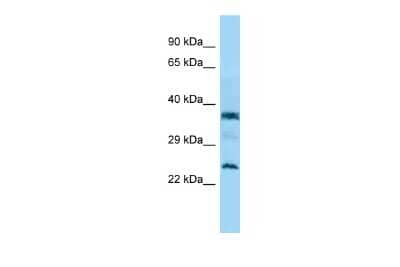 Western Blot: C7orf61 Antibody [NBP2-84569] - WB Suggested Anti-C7orf61 Antibody. Titration: 1.0 ug/ml. Positive Control: Jurkat Whole Cell