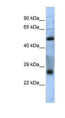 Western Blot: C7orf62 Antibody [NBP1-70480] - Jurkat cell lysate, concentration 0.2-1 ug/ml.