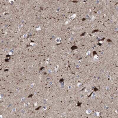 Immunohistochemistry-Paraffin RBM48 Antibody - BSA Free