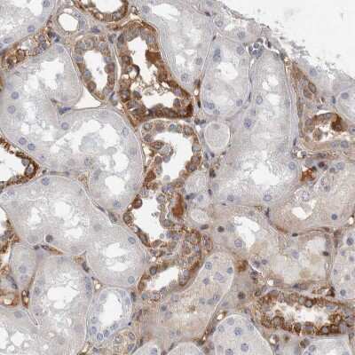 Immunohistochemistry-Paraffin RBM48 Antibody - BSA Free