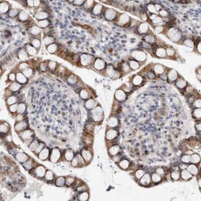 Immunohistochemistry-Paraffin RBM48 Antibody - BSA Free