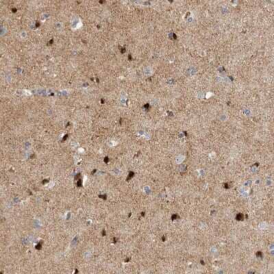 Immunohistochemistry-Paraffin RBM48 Antibody - BSA Free