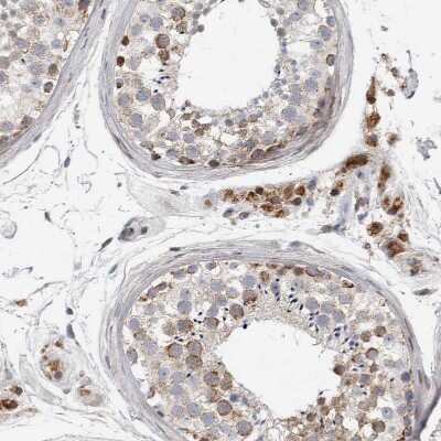 Immunohistochemistry-Paraffin RBM48 Antibody - BSA Free