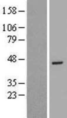 Western Blot RBM48 Overexpression Lysate
