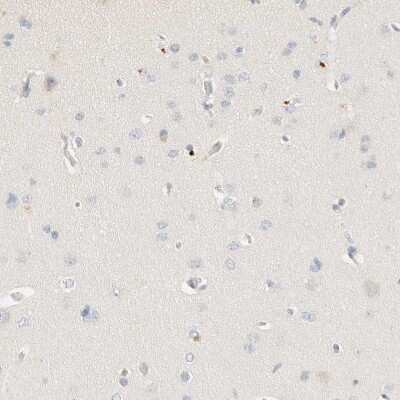 <b>Orthogonal Strategies Validation. </b>Immunohistochemistry-Paraffin: C8B Antibody [NBP1-85990] - Staining of human cerebral cortex shows no positivity in neurons.