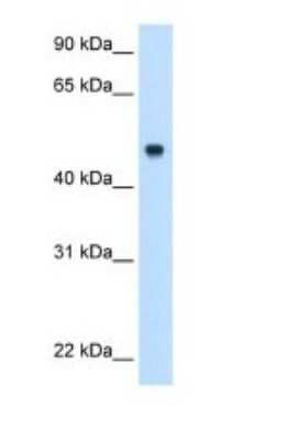 Western Blot: C8B Antibody [NBP1-70481] - Titration: 0.5 ug/mL. Positive Control: Fetal liver cell lysate.