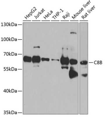 Western Blot: C8B Antibody [NBP2-92538] - Analysis of extracts of various cell lines, using C8B at 1:1000 dilution.Secondary antibody: HRP Goat Anti-Rabbit IgG (H+L) at 1:10000 dilution.Lysates/proteins: 25ug per lane.Blocking buffer: 3% nonfat dry milk in TBST.Detection: ECL Basic Kit .Exposure time: 90s.