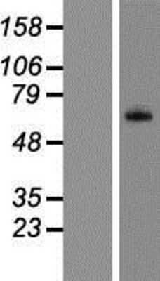Western Blot: C8B Overexpression Lysate (Adult Normal) [NBP2-09058] Left-Empty vector transfected control cell lysate (HEK293 cell lysate); Right -Over-expression Lysate for C8B.
