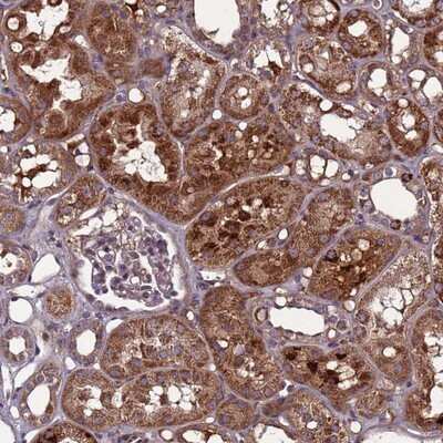 Immunohistochemistry-Paraffin: C8G Antibody [NBP2-14422] - Staining of human kidney shows strong cytoplasmic positivity in cells in tubules.