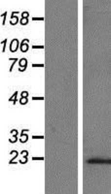Western Blot: C8G Overexpression Lysate (Adult Normal) [NBP2-09007] Left-Empty vector transfected control cell lysate (HEK293 cell lysate); Right -Over-expression Lysate for C8G.