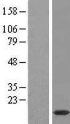 Western Blot: C8orf22 Overexpression Lysate (Adult Normal) [NBL1-08564] Left-Empty vector transfected control cell lysate (HEK293 cell lysate); Right -Over-expression Lysate for C8orf22.