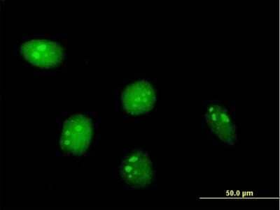 Immunocytochemistry/Immunofluorescence: C8orf33 Antibody [H00065265-B01P] - Analysis of purified antibody to C8orf33 on HeLa cell. (antibody concentration 10 ug/ml)
