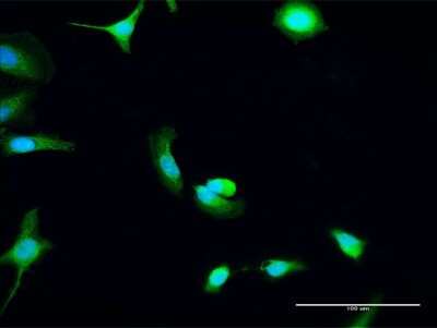 Immunocytochemistry/Immunofluorescence: C8orf33 Antibody [H00065265-D01P] - Analysis of antibody to C8orf33 on HeLa cell. Antibody concentration 30 ug/ml.