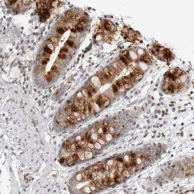 Immunohistochemistry-Paraffin: C8orf33 Antibody [NBP1-82154] - Staining of human rectum shows strong cytoplasmic positivity in goblet cells.
