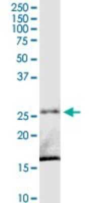 Western Blot: C8orf33 Antibody [H00065265-D01P] - Analysis of C8orf33 expression in human placenta.
