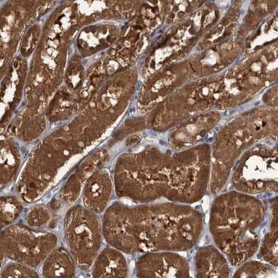 Immunohistochemistry-Paraffin TTI2 Antibody - BSA Free