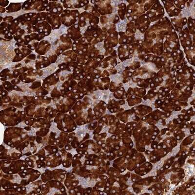 Immunohistochemistry-Paraffin C8orf44 Antibody - BSA Free