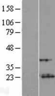 Western Blot VXN Overexpression Lysate