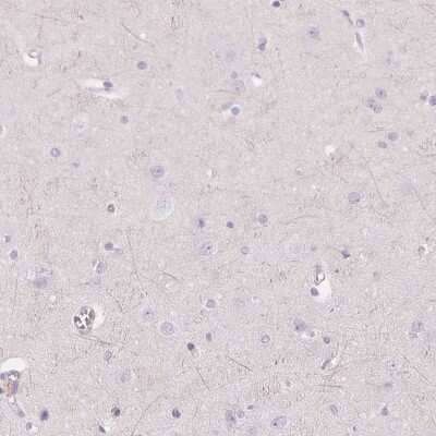 Immunohistochemistry-Paraffin: C8orf47 Antibody [NBP1-93788] - Staining of human cerebral cortex shows low expression as expected.
