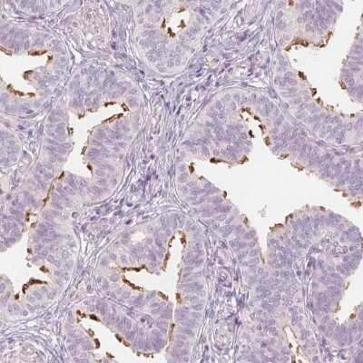 Immunohistochemistry-Paraffin: C8orf47 Antibody [NBP1-93789] - Staining of human fallopian tube shows high expression.