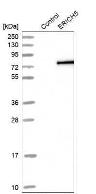 Western Blot: C8orf47 Antibody [NBP1-93788] - Analysis in control (vector only transfected HEK293T lysate) and ERICH5 over-expression lysate (Co-expressed with a C-terminal myc-DDK tag (3.1 kDa) in mammalian HEK293T cells).