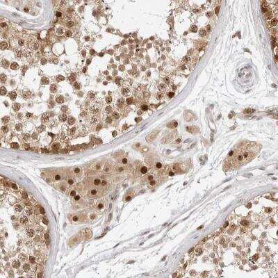 Immunohistochemistry: C8orf48 Antibody [NBP1-93919] - Immunohistochemical staining of human testis shows moderate nuclear and cytoplasmic positivity in cells in seminiferous ducts, Leydig cells were strongly stained.