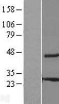 Western Blot: C8orf55 Overexpression Lysate (Adult Normal) [NBL1-08574] Left-Empty vector transfected control cell lysate (HEK293 cell lysate); Right -Over-expression Lysate for C8orf55.