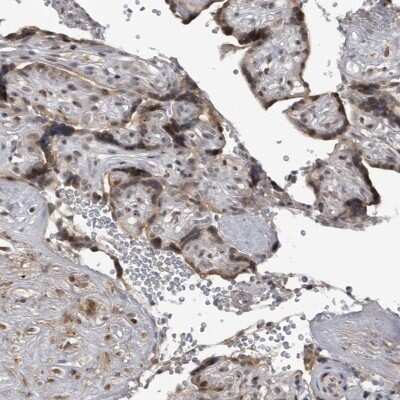 Immunohistochemistry-Paraffin: C8orf58 Antibody [NBP1-93836] - Staining of human placenta shows moderate nuclear and cytoplasmic positivity in trophoblastic cells.
