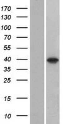 Western Blot: C8orf58 Overexpression Lysate (Adult Normal) [NBP2-08732] Left-Empty vector transfected control cell lysate (HEK293 cell lysate); Right -Over-expression Lysate for C8orf58.